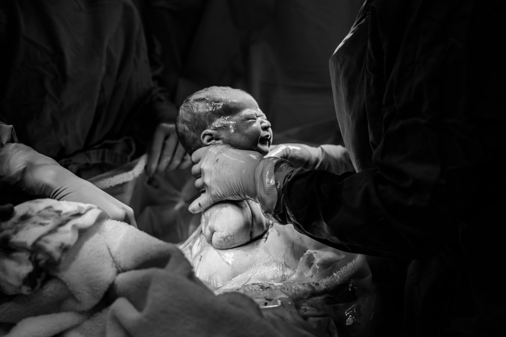 Protected: Pretoria East Birth Photographer – Lume
